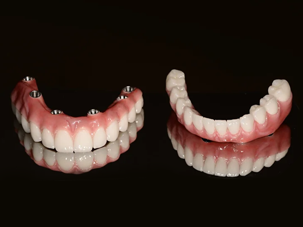 Dinți ficși în 24 ore