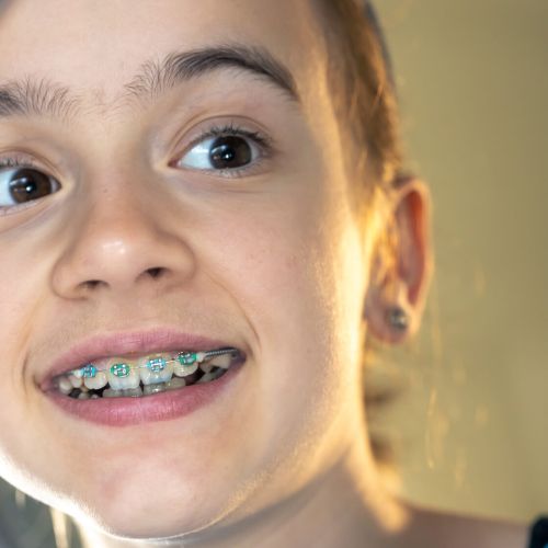 Vezi mai multe cazuri clinice rezolvate de echipa Clinicii Stomatologice FaurDent - Clinică Stomatologică Chișinău