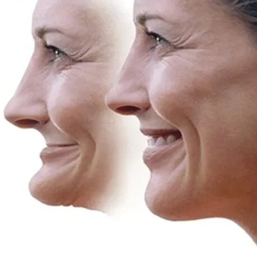  Modificarea formei feței - Clinică Stomatologică Chișinău Buiucani