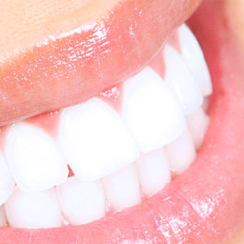 Vezi mai multe cazuri clinice rezolvate de echipa Clinicii Stomatologice FaurDent - Clinică Stomatologică Chișinău