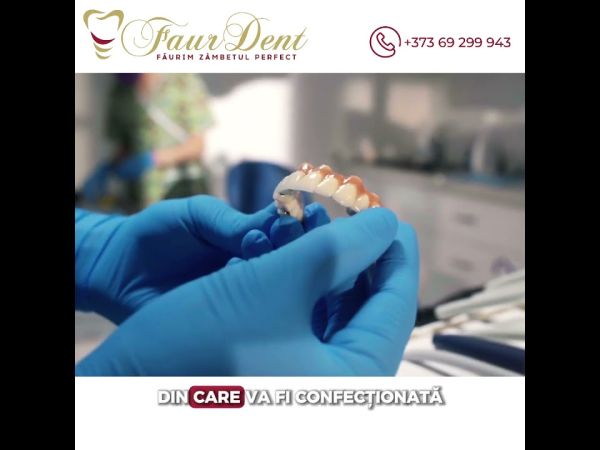 Cât costă o dantură fixă pe implanturi?