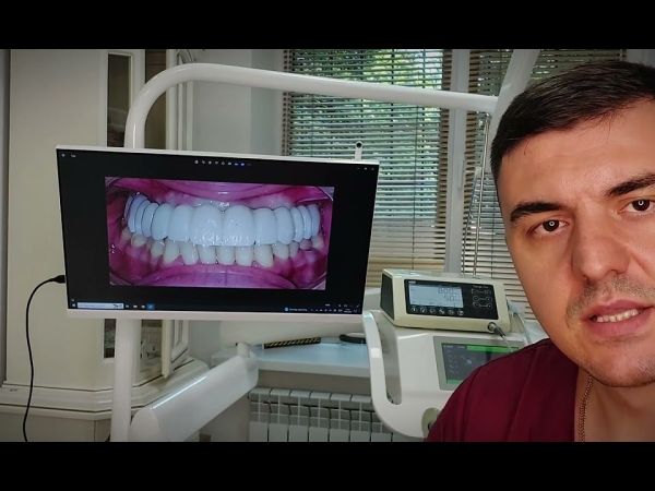 Cum Am Transformat Un Caz Grav de Boală Parodontală într-un Zâmbet Perfect!